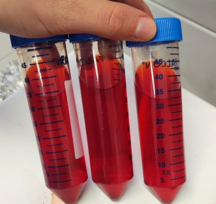 Bacterioruberin: natural pigment for cosmetics & food industries